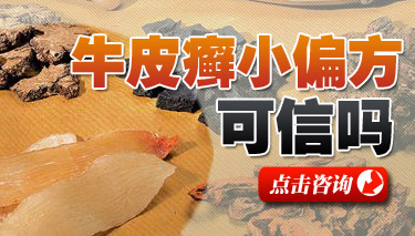 揭开牛皮癣偏方的假面纱