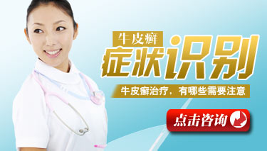 银屑病患者及时正确诊疗重于治疗