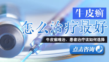 70%银屑病患者沦为二手病人